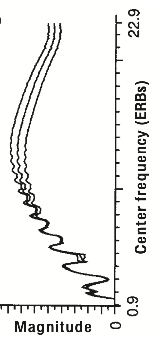 temporal cochlea spectral analysis graph
